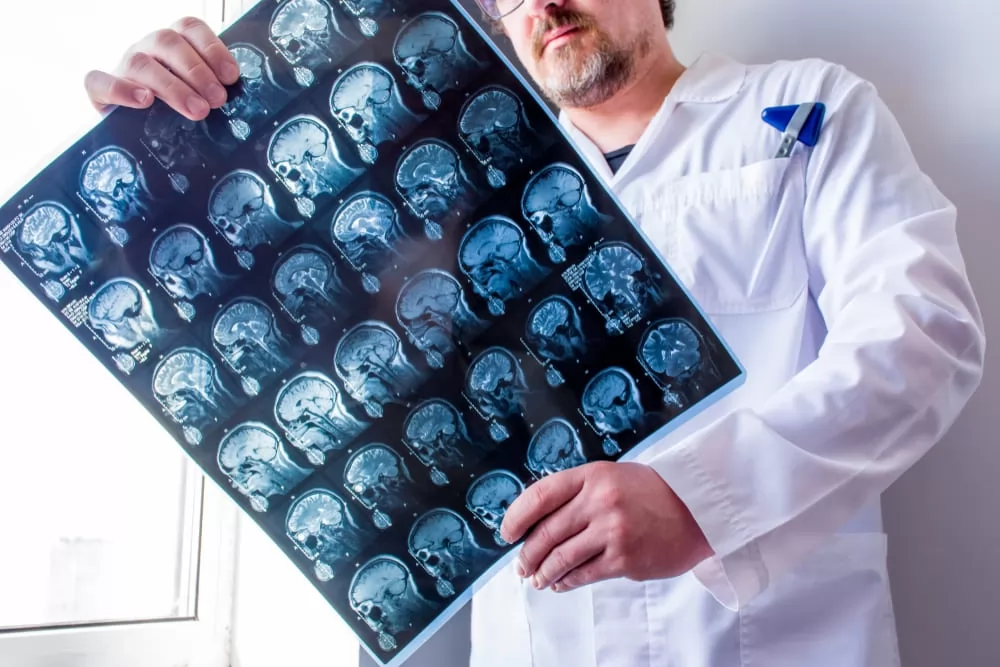 Tumores cerebrales y el rol de la neurocirugía